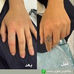 مرکز لیزرو کلینیک زیبایی طراوت