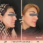 مرکز پزشکی و زیبایی میروژ سنتر