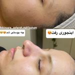 پاکسازی و فیشال پوست