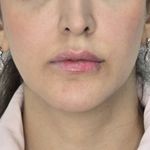 کلینیک پوست ومو الی