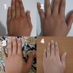 خدمات فیشال پاکسازی، اسکالپ اسکراپ ماهرخ