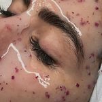 فیشیال آئورا -شبنم جلالی
