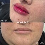 کلینیک لیزر و زیبایی دکتر لیلا حسینی