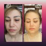 مطب پوست ،مو و لیزر یسنا طب