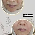 کلینیک لیزر و زیبایی لیلیا