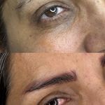 میکروکیماسی( میکروابرو چشم لب،ریمو)