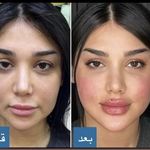 کلینیک زیبایی نامیرا