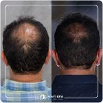 کلینیک پوست مو و زیبایی نوین ایرانا