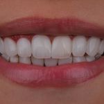 دکترای پروتزهای دندانی اکبری