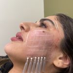 کلینیک پوست،زیبایی ولیزر اِلی(کندلا2025)