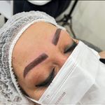 میکروبلیدینگ و میکروپیگمنتیشن ابرو