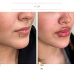 مرکز لیزر و کلینیک زیبایی دکتر با حجب