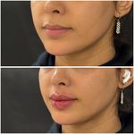 مجموعه لیزر و زیبایی کارنا(شاتی نداریم)