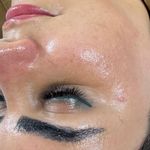 سالن تخصصی پاکسازی پوست هما