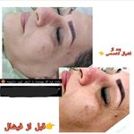 سالن زیبایی گلهو