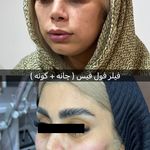 کلینیک آیلی