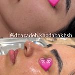 مطب زیبایی آرا