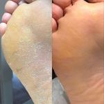 خدمات تخصصی پدیکور درمانی شیوا