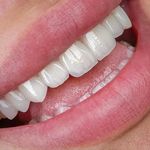 کلینیک دندانپزشکی خاورمیانه نقد و اقساط