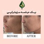 کلینیک زیبایی و مرکز لیزر آیه نقی زاده