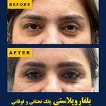 کلینیک زیبایی و جوانسازی پوست و مو الین