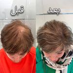 کلینیک پوست، مو، لیزر آنست