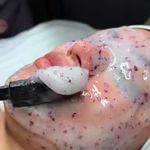 سالن پاکسازی پوست وفیشیال صورت زیبارو