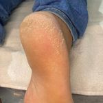 خدمات تخصصی پدیکور درمانی شیوا