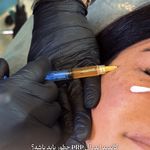 کلینیک زیبایی و لیزر سلن مشهد