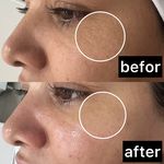 خدمات تخصصی پوست (فیشیالیست رویا صالحی)