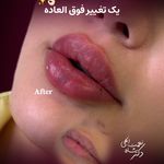 پوست مو فیلر جوانساز دکتر شاه نعمت الهی