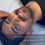 فیزیوتراپی بابیمه طرح رایگان