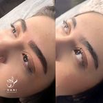 مرکز فوق تخصصی میکروبلیدینگ ابرو هانی