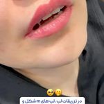 کلینیک زیبایی شایلی