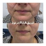 کلینیک زیبایی و لیزر مو زائد نوبا