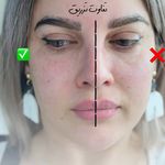 کلینیک لیزر  کندلاوزیبایی پوست ومو آیشیل
