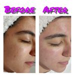 فیشال درمانی و پاکسازی پوست میرجلیلی