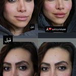 کلینیک زیبایی پوست و لیزر آلن