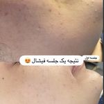 مرکز لیزر ،پوست و زیبایی کندی بیوتی