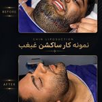 کلینیک تخصصی زیبایی و لیزر موی ابریشم