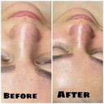 خدمات پوست ومو و لیزر موهای زائد