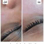 پاکسازی پوست و فیشیال الهه ماه پروی