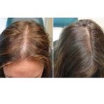 کلینیک پوست و مو و لیزر نیلوفر آبی