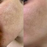 خدمات تخصصی تتو و کاموفلاژ بانوان- تارا