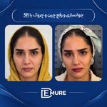 مرکز تخصصی زیبایی و جوانسازی دمور