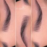 مرکز تخصصی فیبروز ابرو حانیه فراهانی