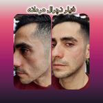 مطب پوست ،مو و لیزر یسنا طب