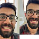 دندانسازی محلات (فتح المبین )