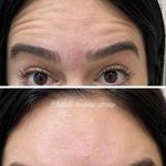 مرکز لیزر ،پوست و زیبایی کندی بیوتی