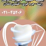 مرکز تخصصی ایمپلنت